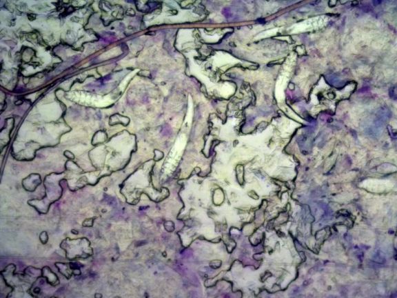 Скотч-тест: взрослые особи клещей Demodex canis