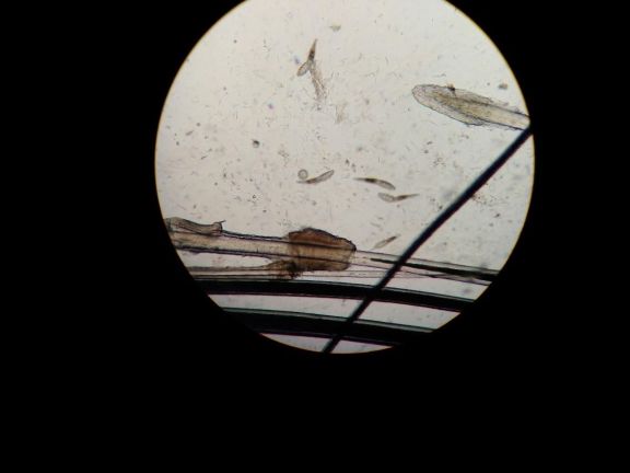 Трихоскопия: взрослые особи клещей Demodex canis